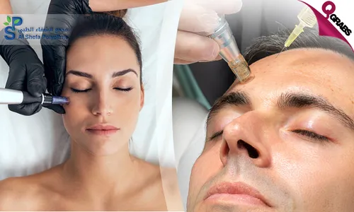 Mesotherapy + Dermapen Skin Treatment at Al Shefa Polyclinic!